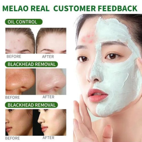 green-mask-stick-facial-mask-for-black-spots-pimples-big-4