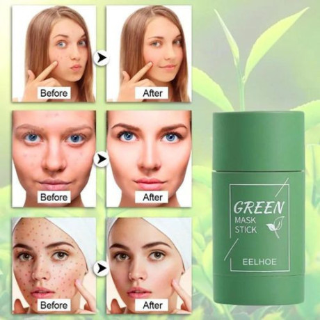 green-mask-stick-facial-mask-for-black-spots-pimples-big-1