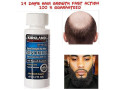 kirkland-signature-minoxidil-5-extra-strength-bald-hair-beard-growth-for-men-small-0