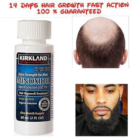 kirkland-signature-minoxidil-5-extra-strength-bald-hair-beard-growth-for-men-big-0