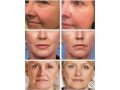 retinol-face-cream-facial-lifting-anti-aging-cream-small-0