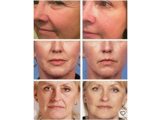 Retinol Face Cream Facial Lifting Anti Aging Cream
