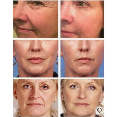 retinol-face-cream-facial-lifting-anti-aging-cream-big-0