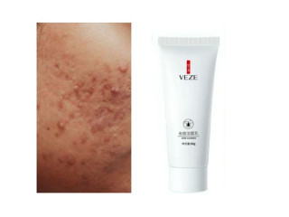 VENZEN Acne Facial Wash/ Cleanser ( Clear Acne & Oil Control For Acne Prone Skin).
